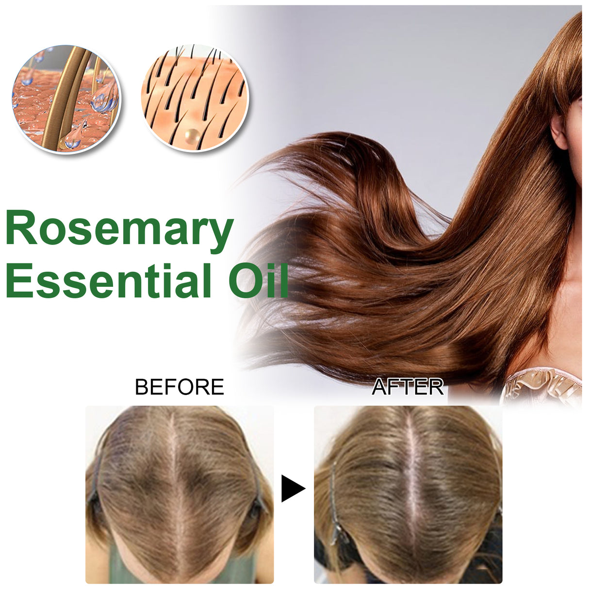 Rosemary Essential Oil, Anti-Hair Loss Refreshing, Nourishing, Smooth Hair Thick Hair And Scalp Care Essential Oil - V.I.P Digital Presence
