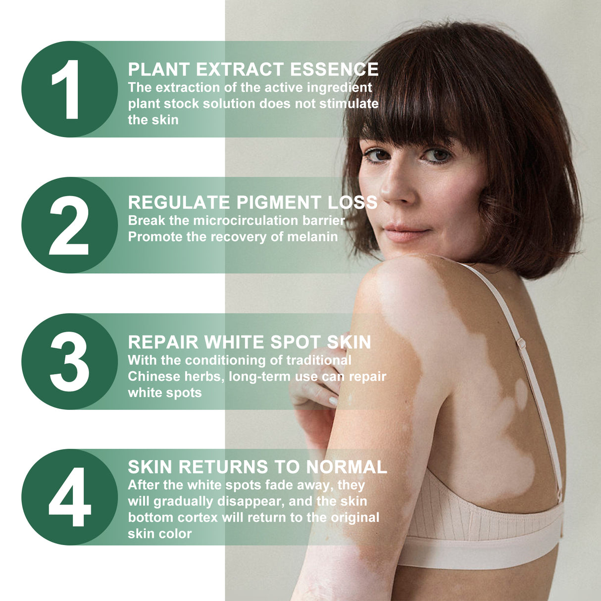 Vitiligo Relief Cream, Repair White Spots Flower Spots Skin Topical Care Ointment - V.I.P Digital Presence