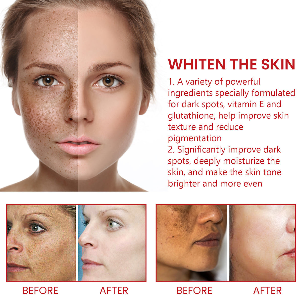 Dark Spot Repair Cream, Restores Dull Skin, Lightening Fine Lines And Dark Spots, Brightening Skin Repair Cream - V.I.P Digital Presence