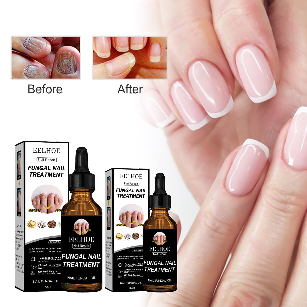 Nail Repair Solution Thickening And Brightening Nails Removing Gray Nail Repair Nourishing Nail Care Solution - V.I.P Digital Presence