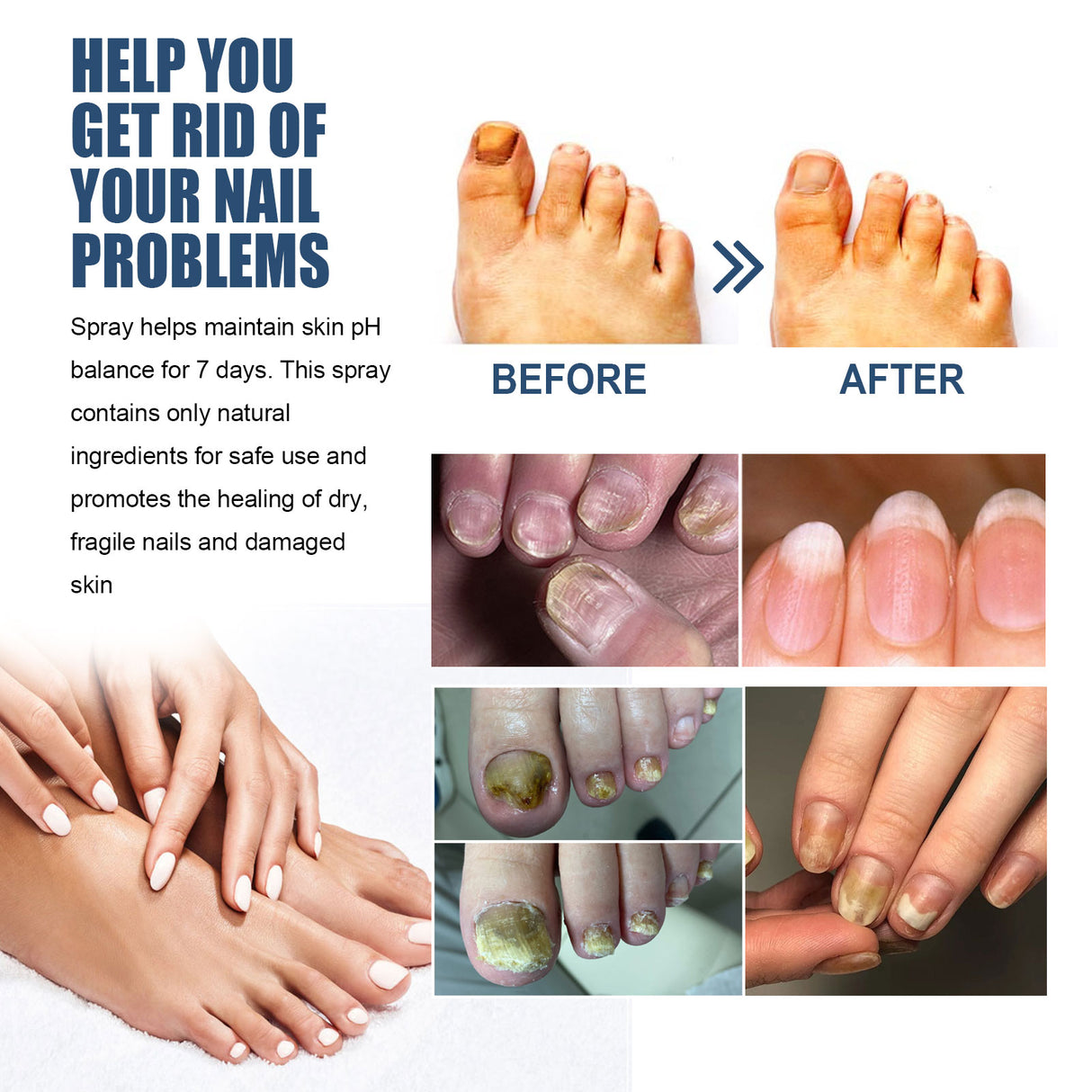 Nail Care Spray Gently Cleans Foot Nails Moisturizing And Brightening Nail Care Spray - V.I.P Digital Presence