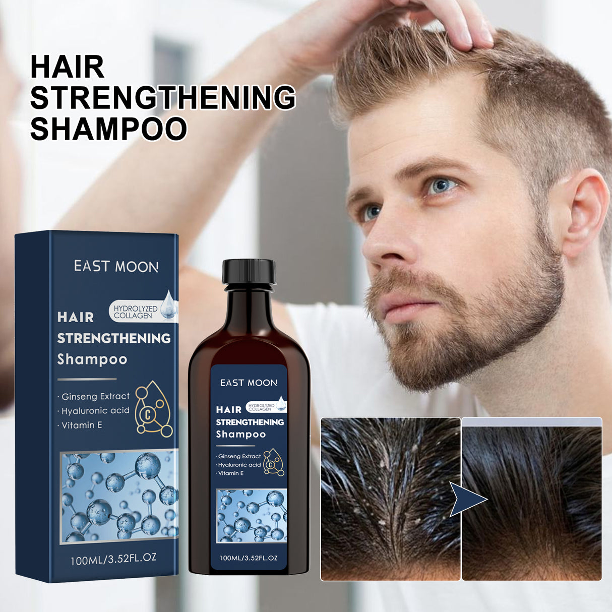 Men's Shampoo Deep Clean Moisturizing Root And Scalp Massage Nourishing Treatment Shampoo - V.I.P Digital Presence