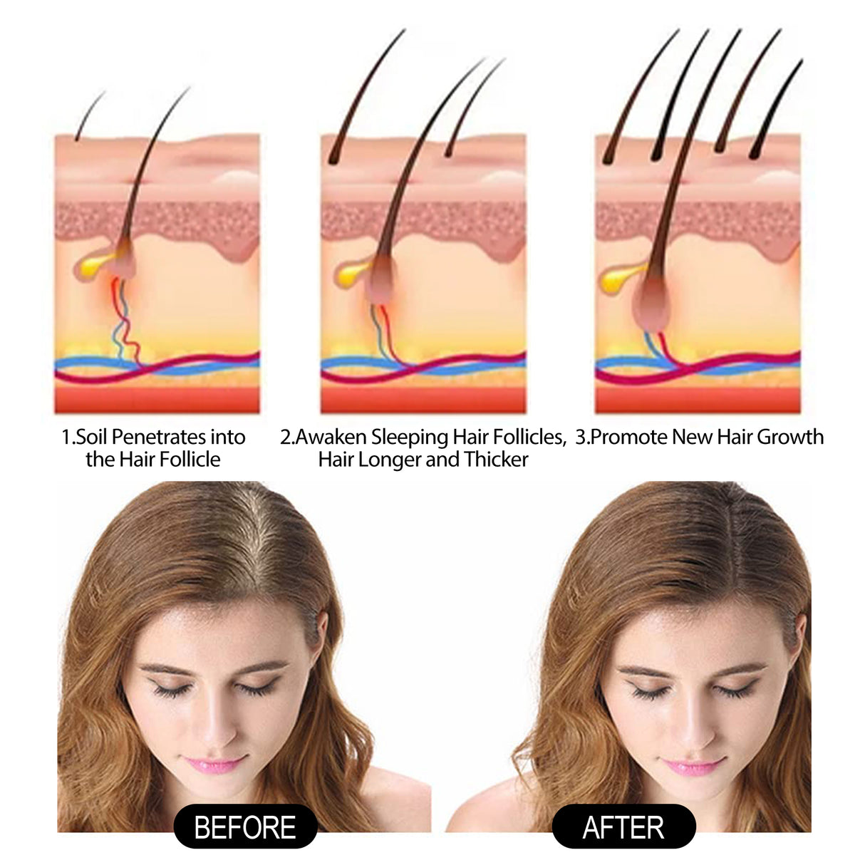 Hair Essence, Repair Dry Hair, Moisturize Hair Roots And Scalp Hair Essence - V.I.P Digital Presence