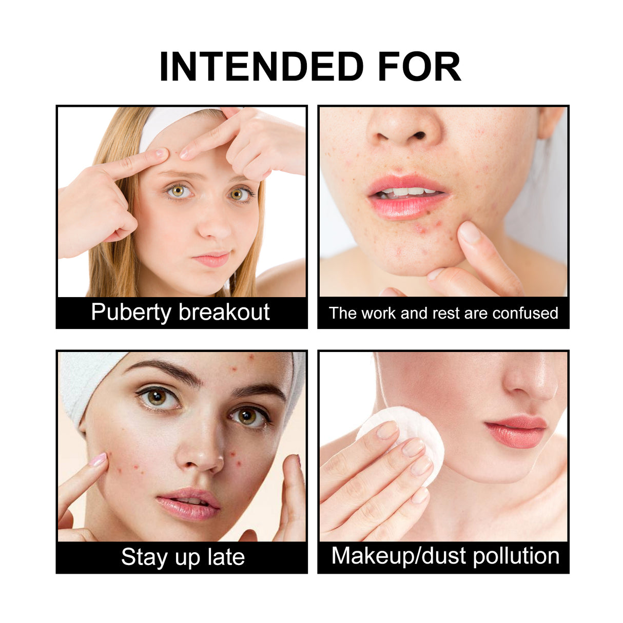 JAYSUING Cute Black Acne Patch, Facial Acne Lightening Repair Acne Closing Acne Mark Blackhead Removal