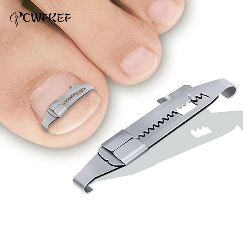 Ingrown Toenail Corrector Tools Pedicure Recover Embed Toe Nail Treatment Professional Ingrown Toenail Correction Foot Care Tool - V.I.P Digital Presence