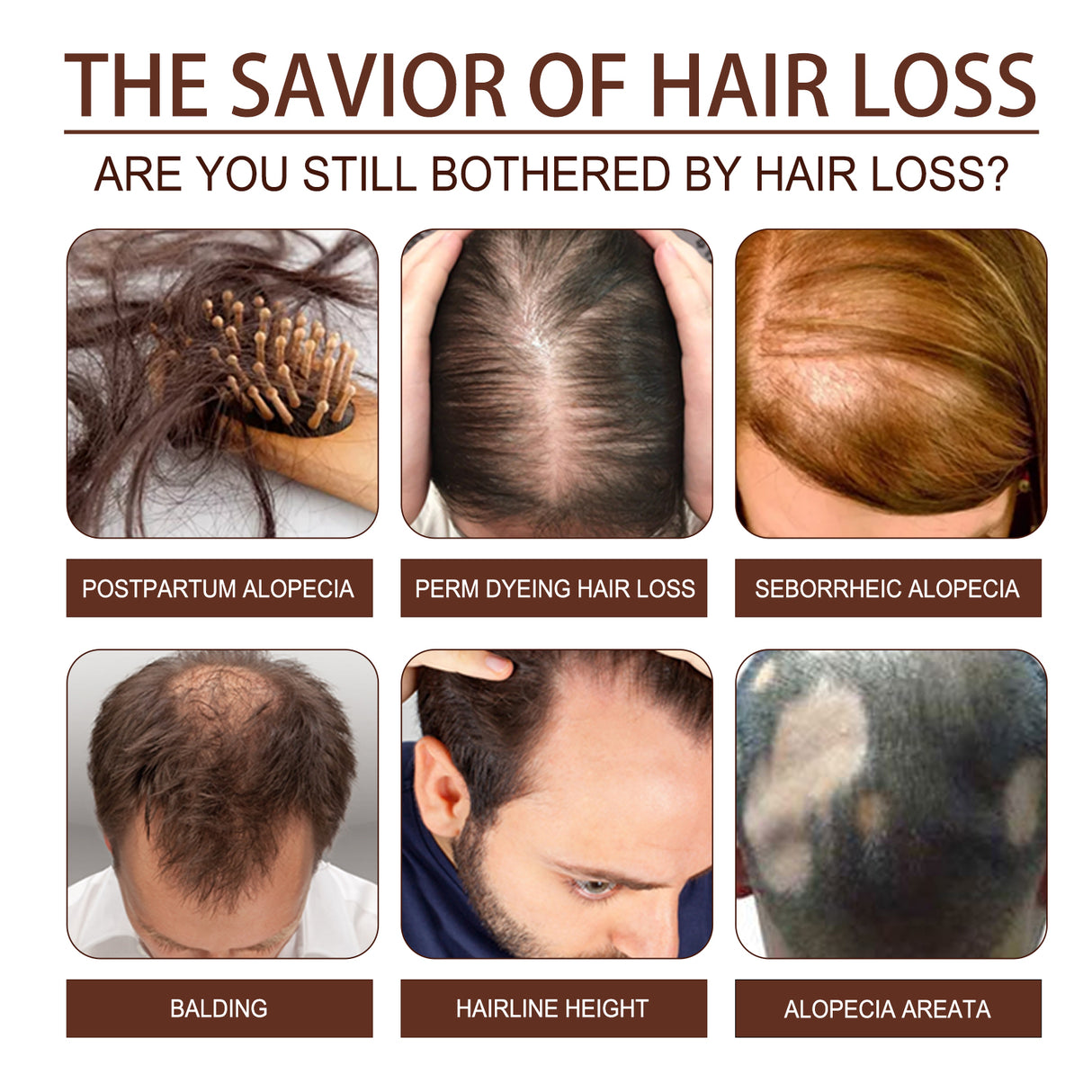 Castor Oil Hair Dense Essential Oil Repair Damaged Hair, Nourish Scalp, Strengthen Hair And Prevent Hair Loss - V.I.P Digital Presence