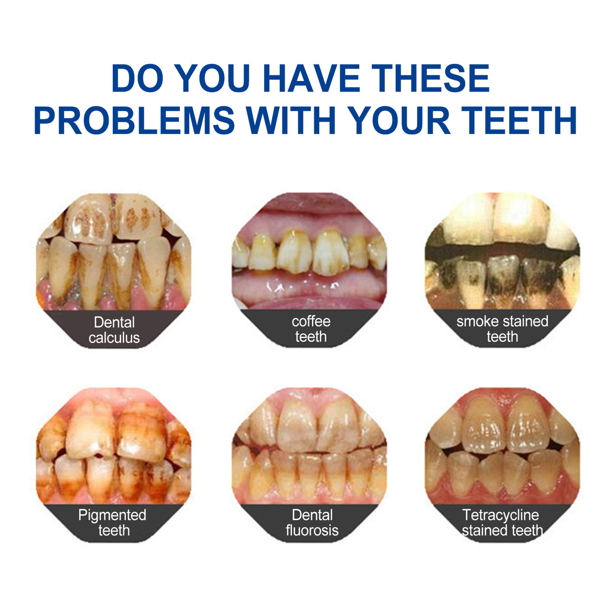 Dental pencil Teeth Cleaning Remove Dirt And Yellow Smoke Teeth Brightening Whitening Oral Cleaning Pen - V.I.P Digital Presence