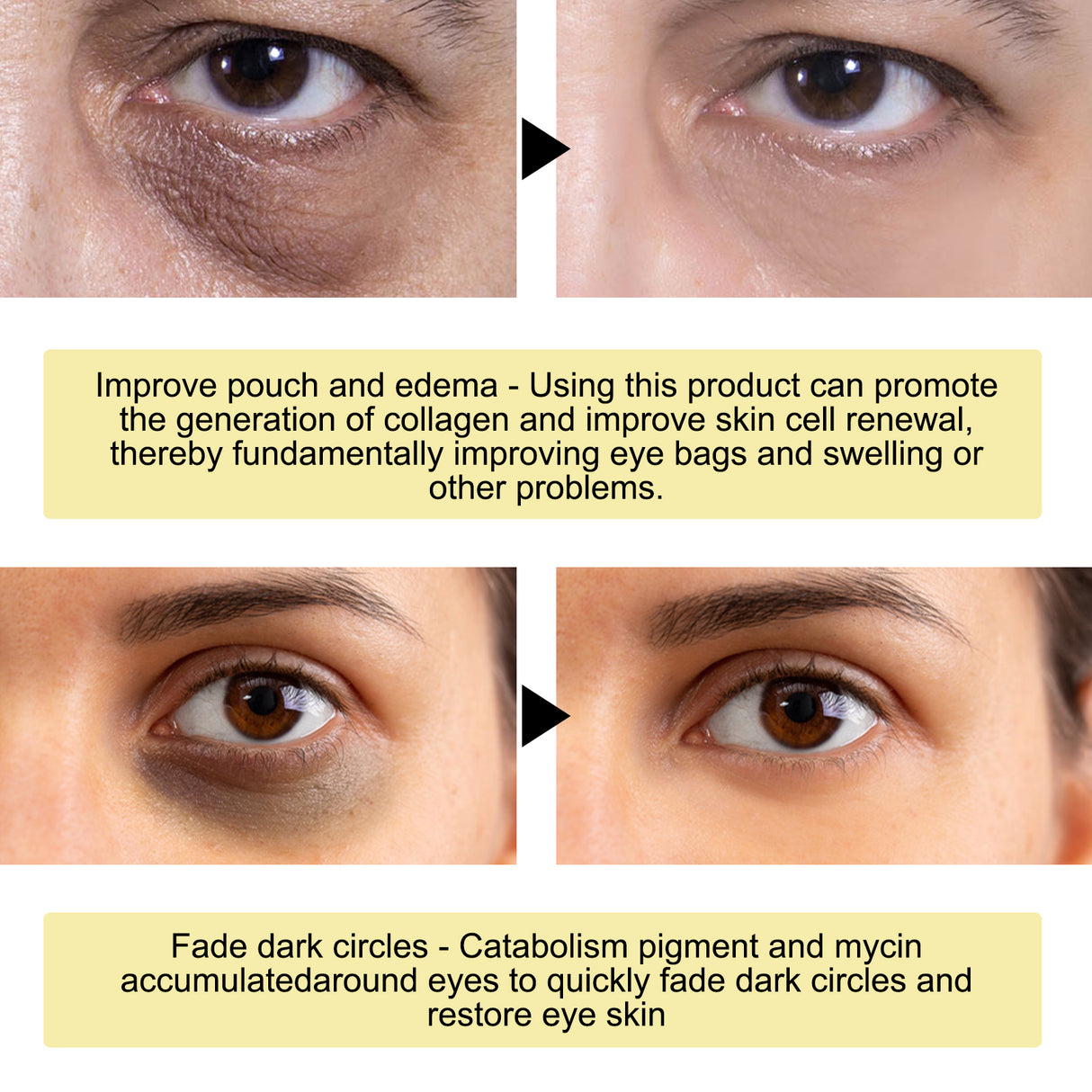 Gold Snail Collagen Eye Mask, Reduces Fine Lines And Puffiness, Hydrates Tightens And Anti-wrinkle Eye Mask