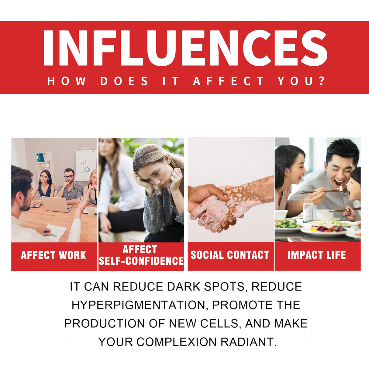 Dark Spot Whitening Cream, Lightening Yellow Brown White Spot Cream Dark Spots Correct Skin Tone Moisturize Skin Whitening - V.I.P Digital Presence