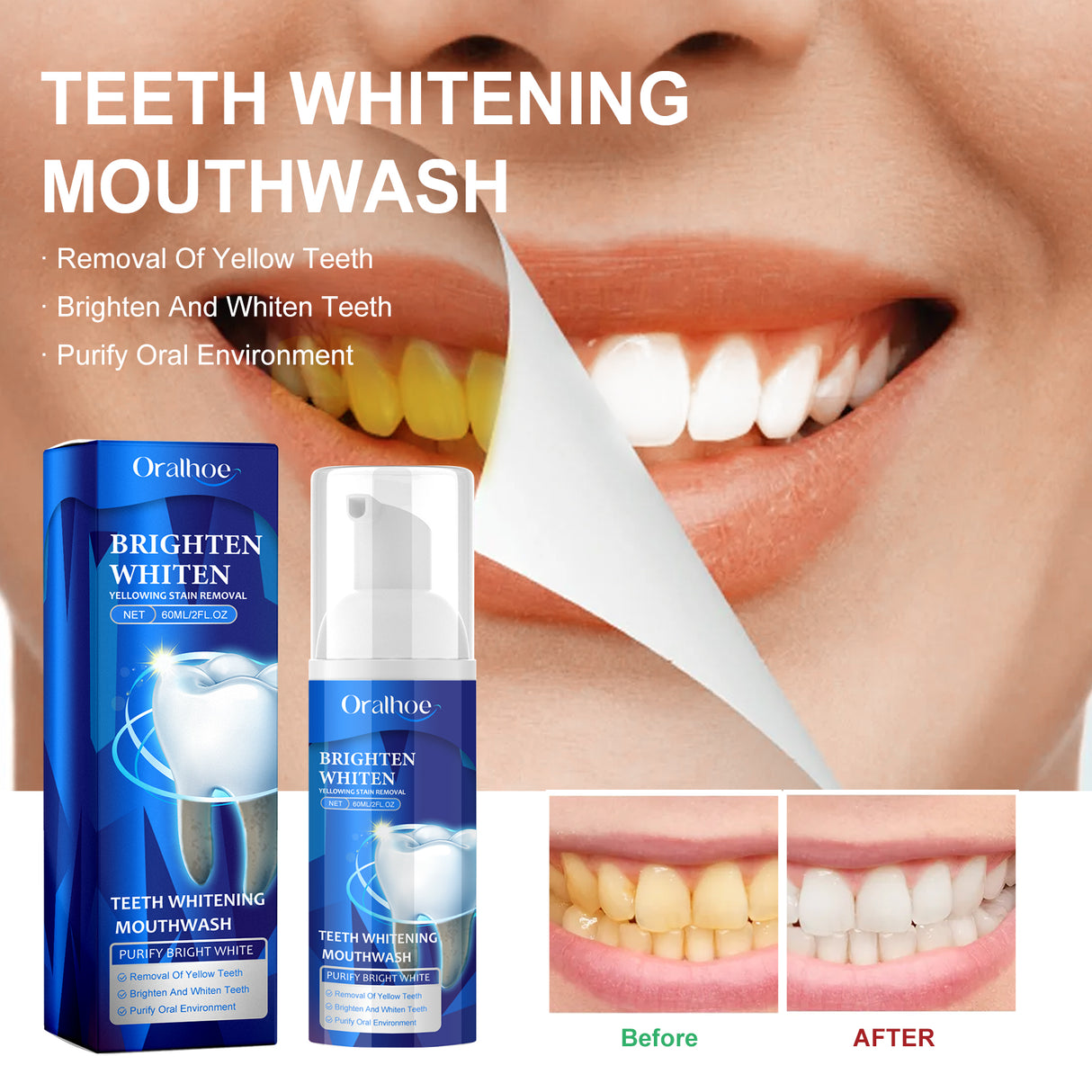 Teeth Whitening Mouthwash, Teeth Cleaning Teeth Yellow Stains Tartar Beauty Teeth Fresh Breath Oral Care - V.I.P Digital Presence