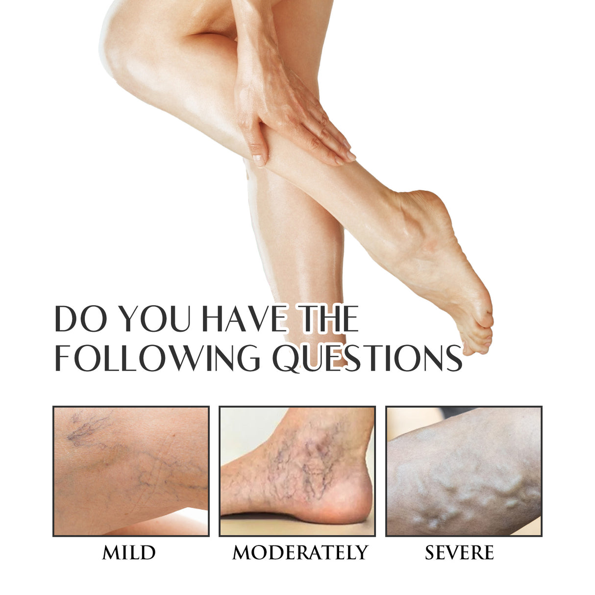 Varicose Veins Soothing Spray, Relief Of Sore Leg Muscles Massage Repair Earthworm Leg Vein Treatment Spray - V.I.P Digital Presence