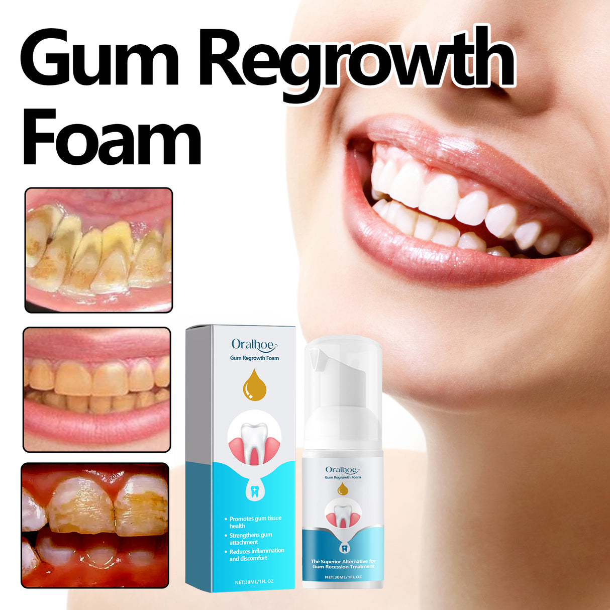 oralhoe Gum Regrowth Foam, Clean Teeth Tartar Care Gums Clean Teeth Anti-Moth Fresh Breath Mousse - V.I.P Digital Presence