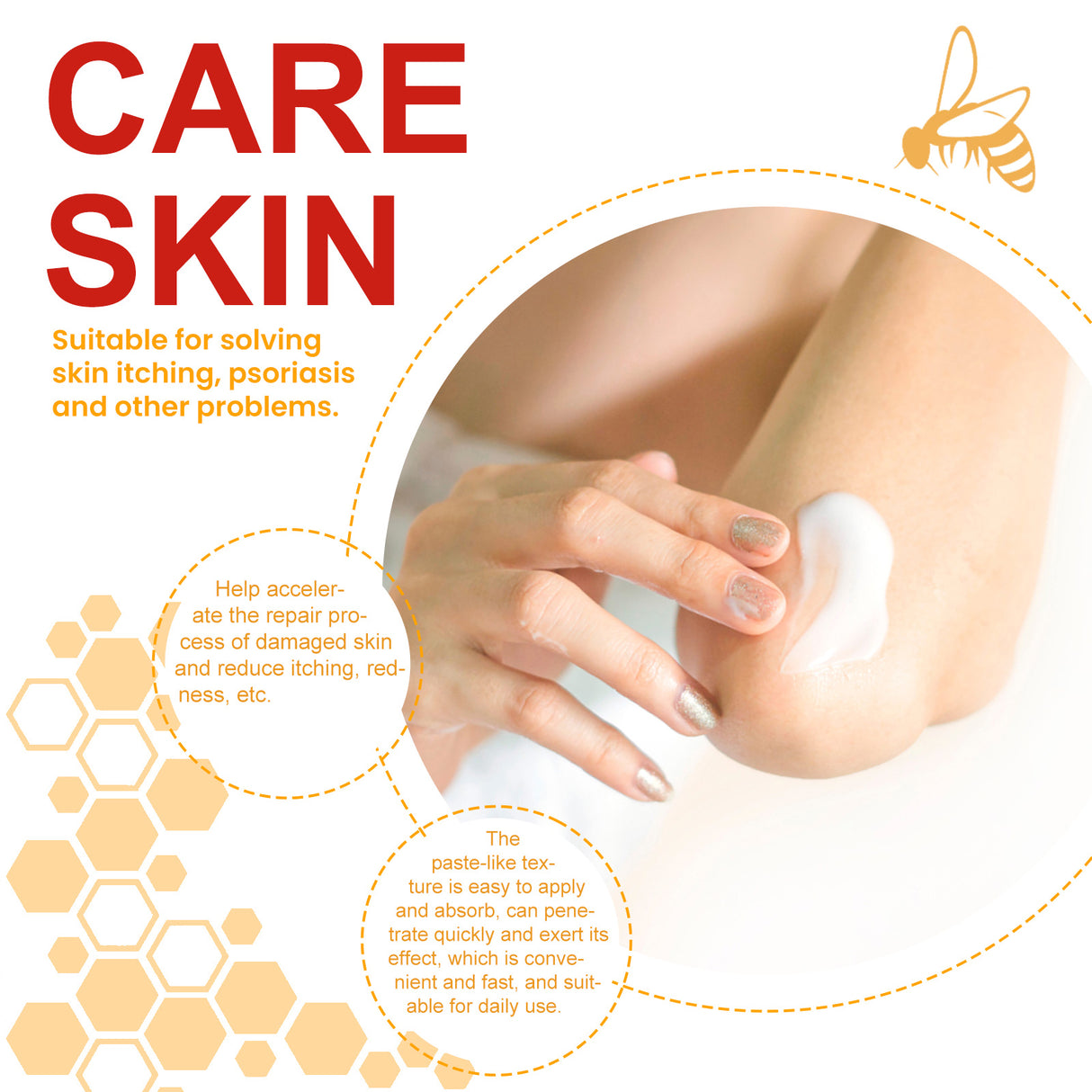 Bee-Poison Cowhide Moss Cream, Which Relieves Redness And Itchiness Of Skin - V.I.P Digital Presence