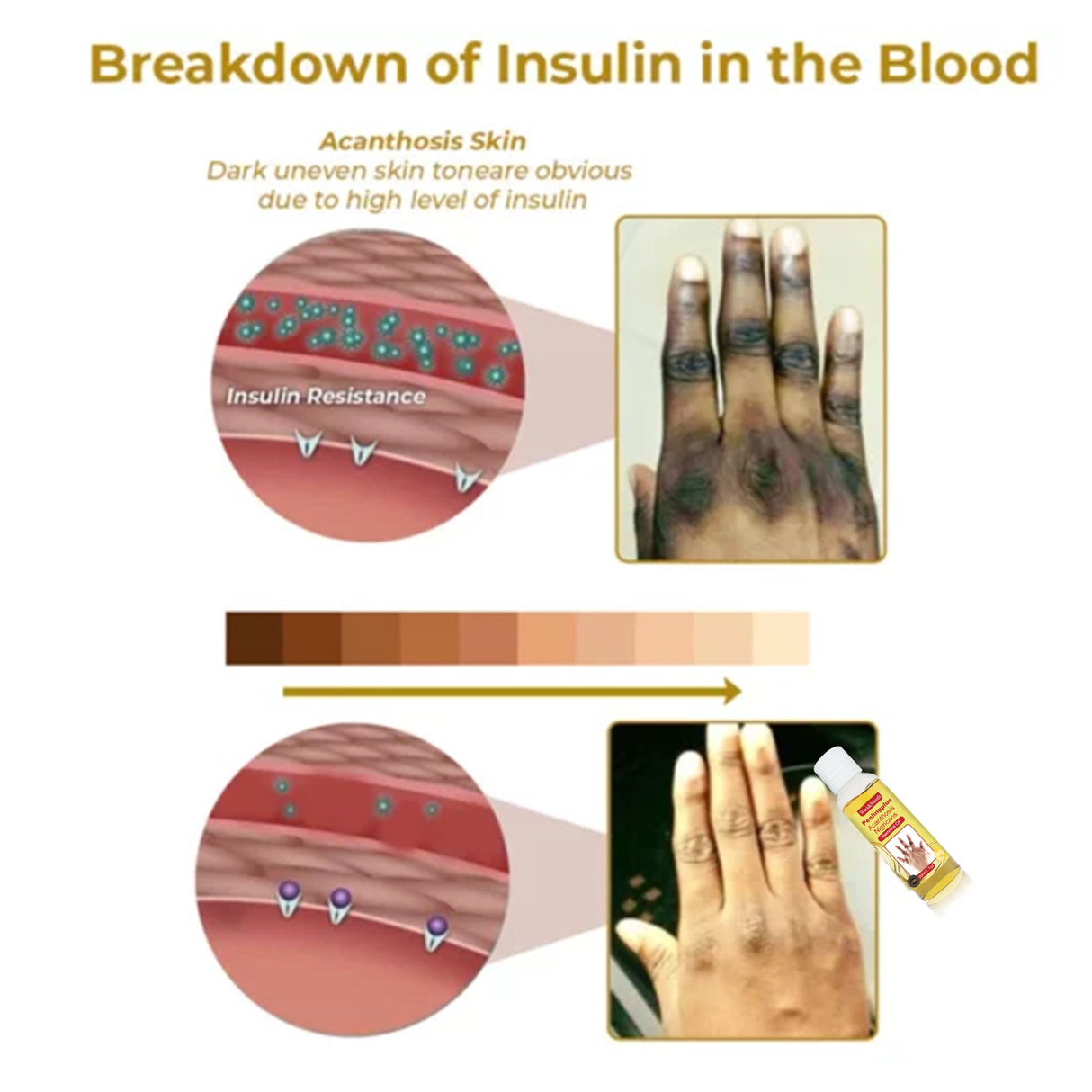 Acanthosis Nigricans Removal Oil, Exfoliating Light Black Brightening And Beauty Skin Oil - V.I.P Digital Presence