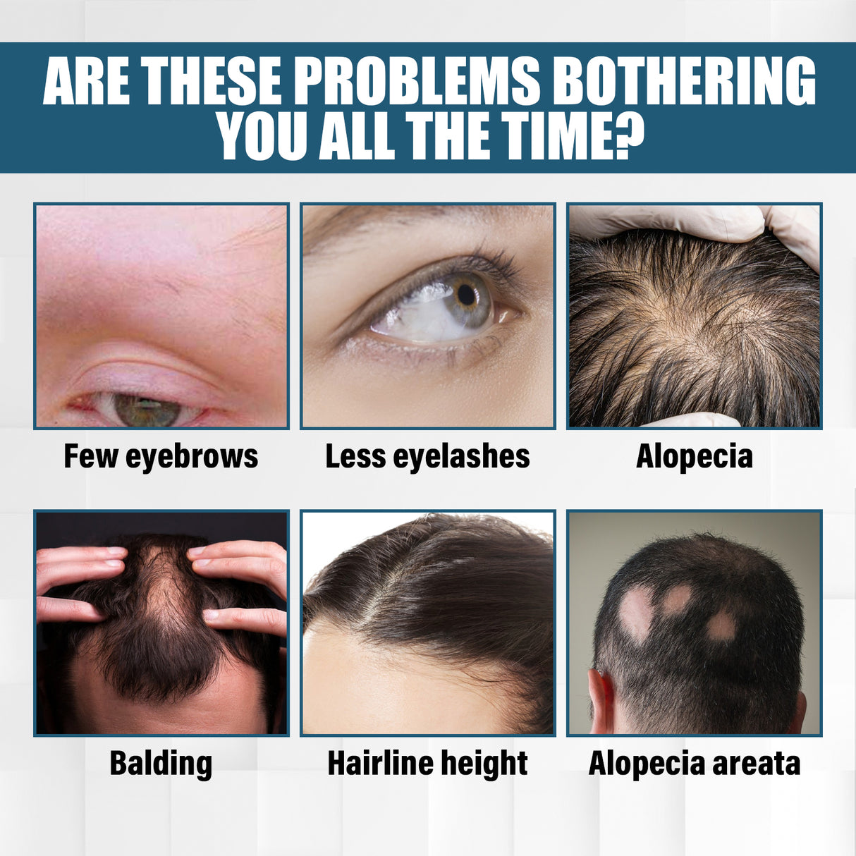 Hair Essence Spray, Prevent Hair Loss Repair Hair Dry And Frizzy Moisture And Dense Hair Essence - V.I.P Digital Presence