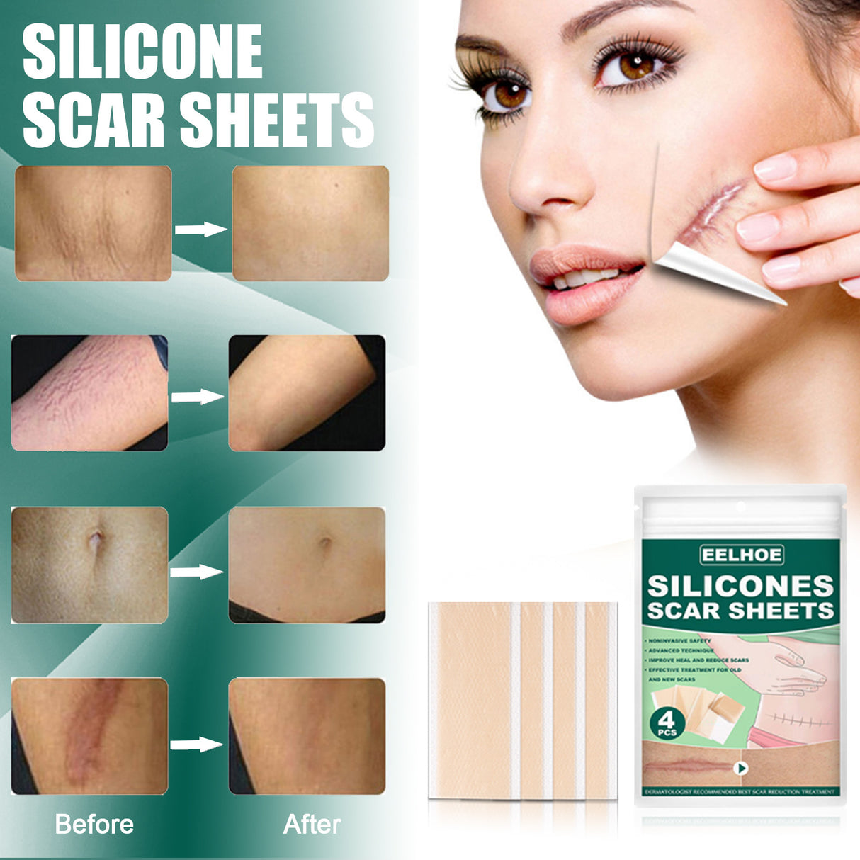 Silicone Gel Repair Patch, Fade Marks Transparent Care Skin Repair Patch - V.I.P Digital Presence