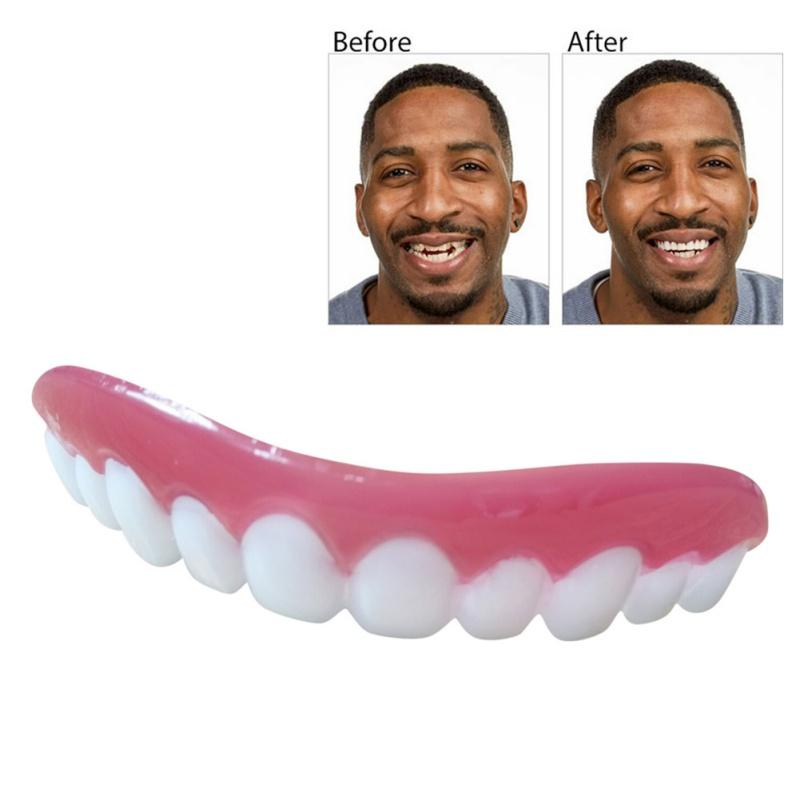 Perfect Smile Veneers Dub In Stock For Correction of Teeth For Bad Teeth Give You Perfect Smile Veneers mouth support - V.I.P Digital Presence