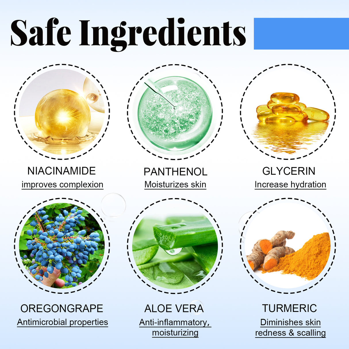 Psoriasis Relief Spray, Relieve Skin, Hands And Feet Redness Peeling Itch Repair External Care - V.I.P Digital Presence