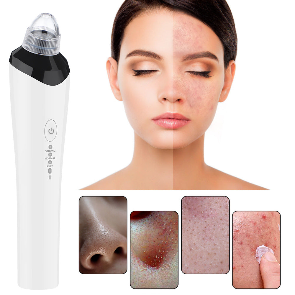 High-Definition Visual Blackhead Meter Three-Speed Intelligent Vacuum Adsorption Pore Cleaner Wifi Timing - V.I.P Digital Presence