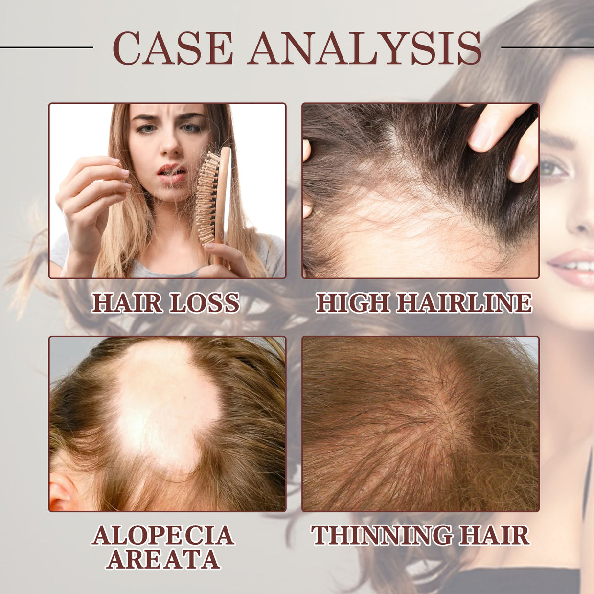 Coconut Hair Essential Oil, Moisturizes Tightens And Strengthens Hair Scalp Massage Essential Oil - V.I.P Digital Presence