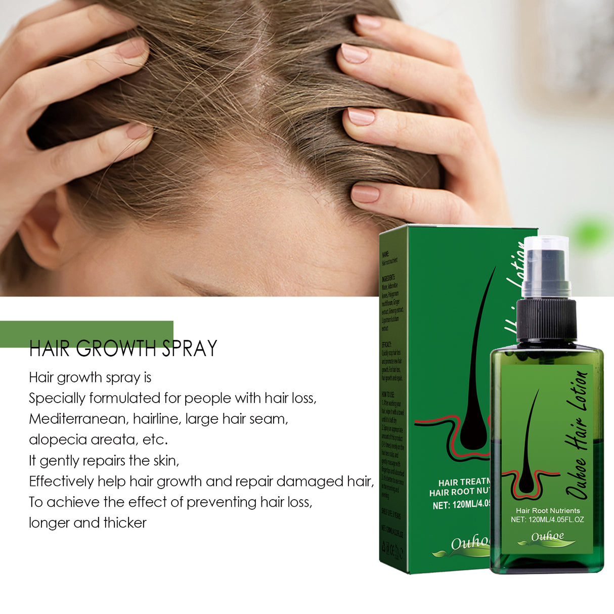 Dense Hair Spray, Anti-Loss Hair Strengthening Hair Repair Hair Root Hair Care Spray - V.I.P Digital Presence