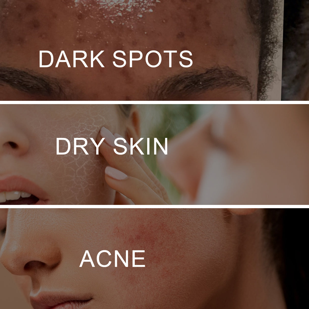 Dark Spot Whitening Cream, Lightening Yellow Brown White Spot Cream Dark Spots Correct Skin Tone Moisturize Skin Whitening - V.I.P Digital Presence