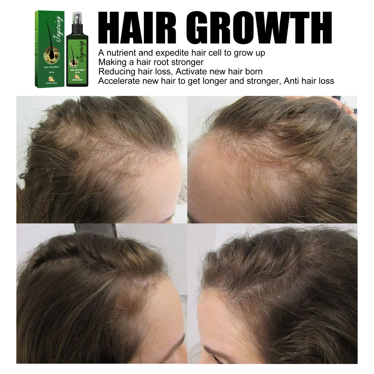 Hair Care Solution Gently Nourishes And Massages Scalp, Moisturizes And Softens Hair Care Spray - V.I.P Digital Presence