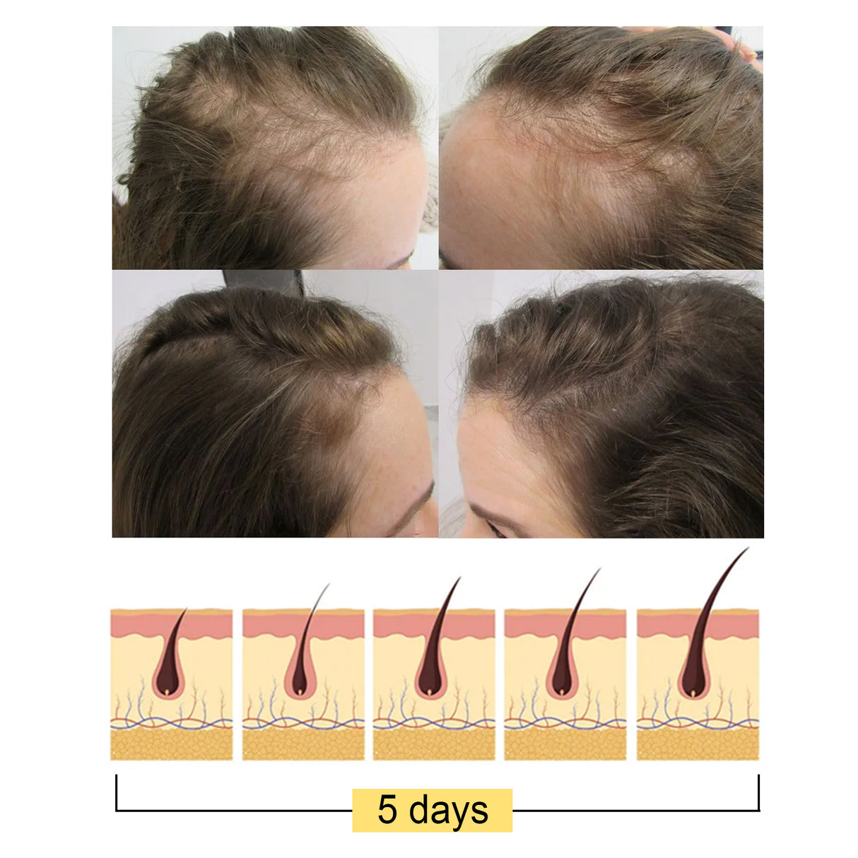 Ginger Dense Hair Soap, Moisturizes Hair Ends And Roots Cleansing Scalp Hair Care Shampoo Soap - V.I.P Digital Presence