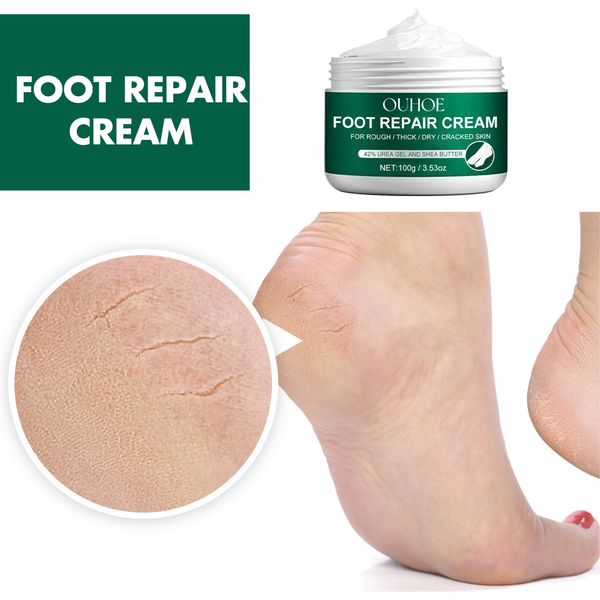 Foot Repair Cream, Repair Heel Crack Dry Itching Skin Nourishing Moisturizing Moisturizing Foot Care Cream - V.I.P Digital Presence