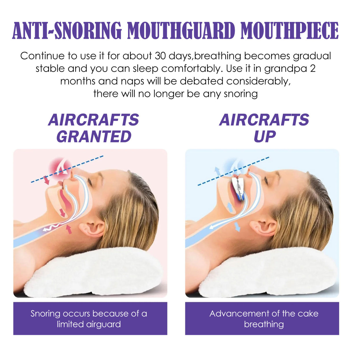 Anti-Grinding And Anti-Snoring Braces To Prevent Snoring Grinding Teeth At Night Mouthguard Protective Braces For Teeth - V.I.P Digital Presence