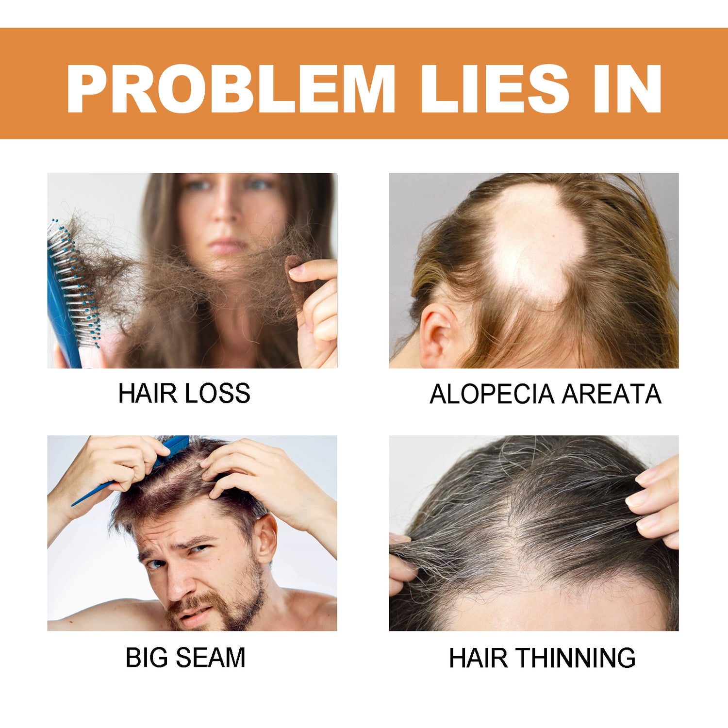 Mypa Ampoule, Strengthen And Repair Hair, Prevent Hair Loss, Strengthen Hair Root And Thicken Hair And Scalp Massage Solution - V.I.P Digital Presence