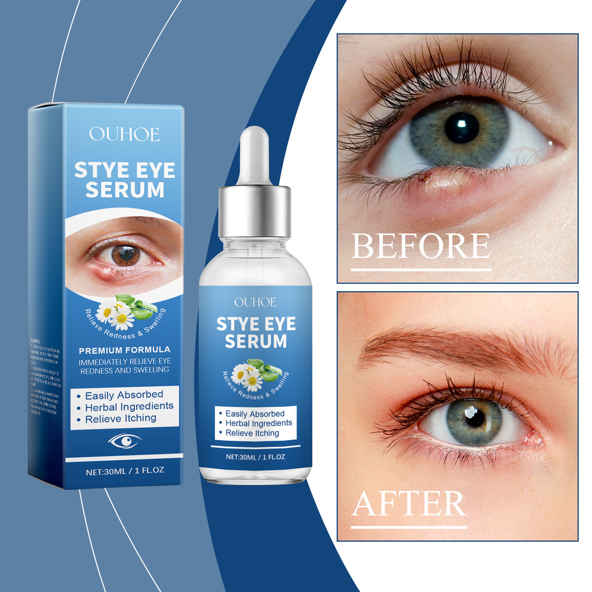 Eye Care Solution, A Gentle Moisturizing Eye Solution That Relieves Acidness, Is A Daily Portable Eye Care Drops - V.I.P Digital Presence