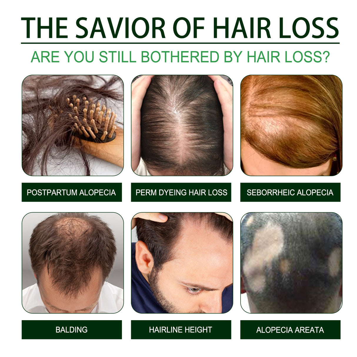 Black Castor Oil, Thickening Hair Repair Soft Massage Scalp To Strengthen Hair Strands - V.I.P Digital Presence