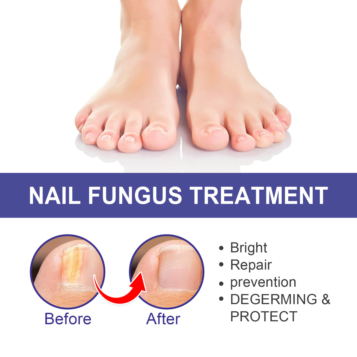 Nail Repair Lotion, Repair Thickening Nail Inlay Gray Nail Shine Soft Nail Care Solution - V.I.P Digital Presence