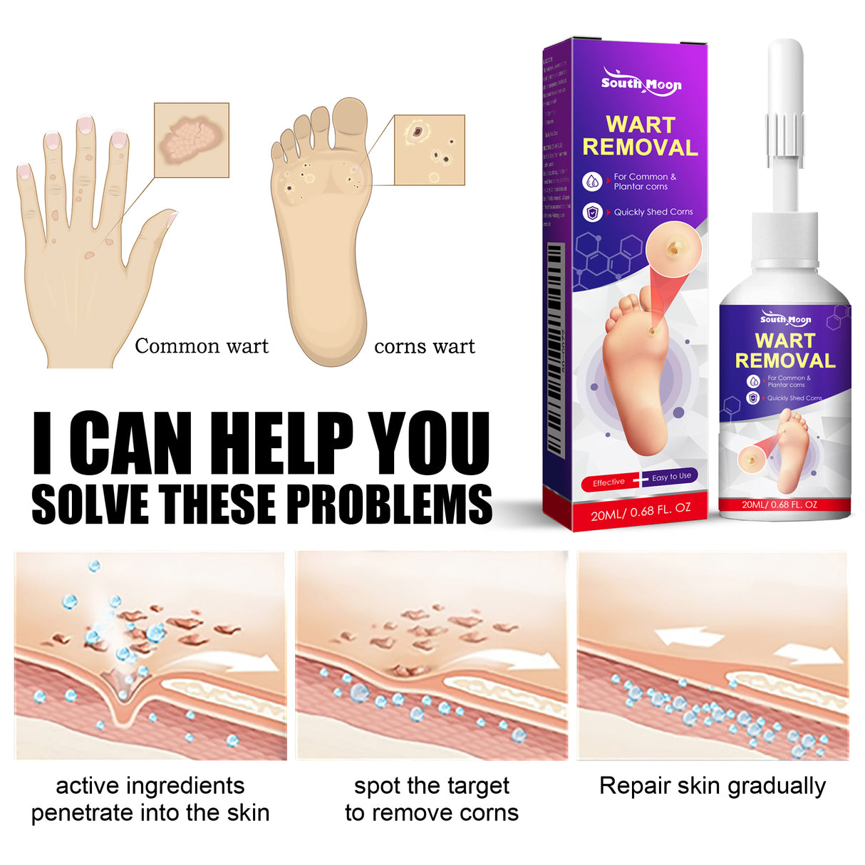 Remove Chicken Eye Lotion Extra Clear Remove Corns Skin Care Chicken Calluses Foot Pad Gram Warts - V.I.P Digital Presence
