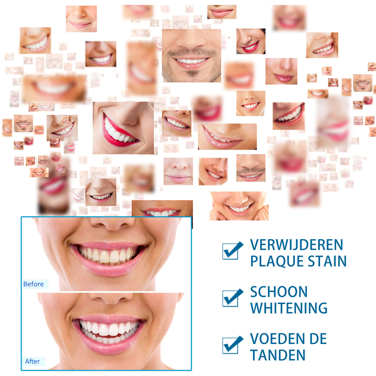 Teeth Whitening Pen Clean Beauty Brightening Gel Mouth Clean Yellow Teeth Tea Stains Smoke Stains Clean Teeth Stains Clean - V.I.P Digital Presence