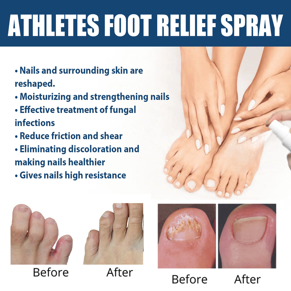 Athletes Foot Relief Spray, Relieve Foot Sweat Foot Itching Peeling Gray Nails Foot Odor Moisturizing Care Spray - V.I.P Digital Presence