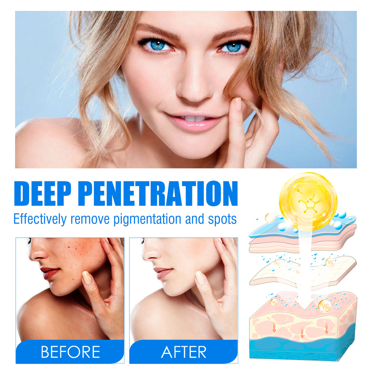 Blemish Cream, Whitening Skin Reduce Melanin Melasma Stains And Hydrating Cream - V.I.P Digital Presence