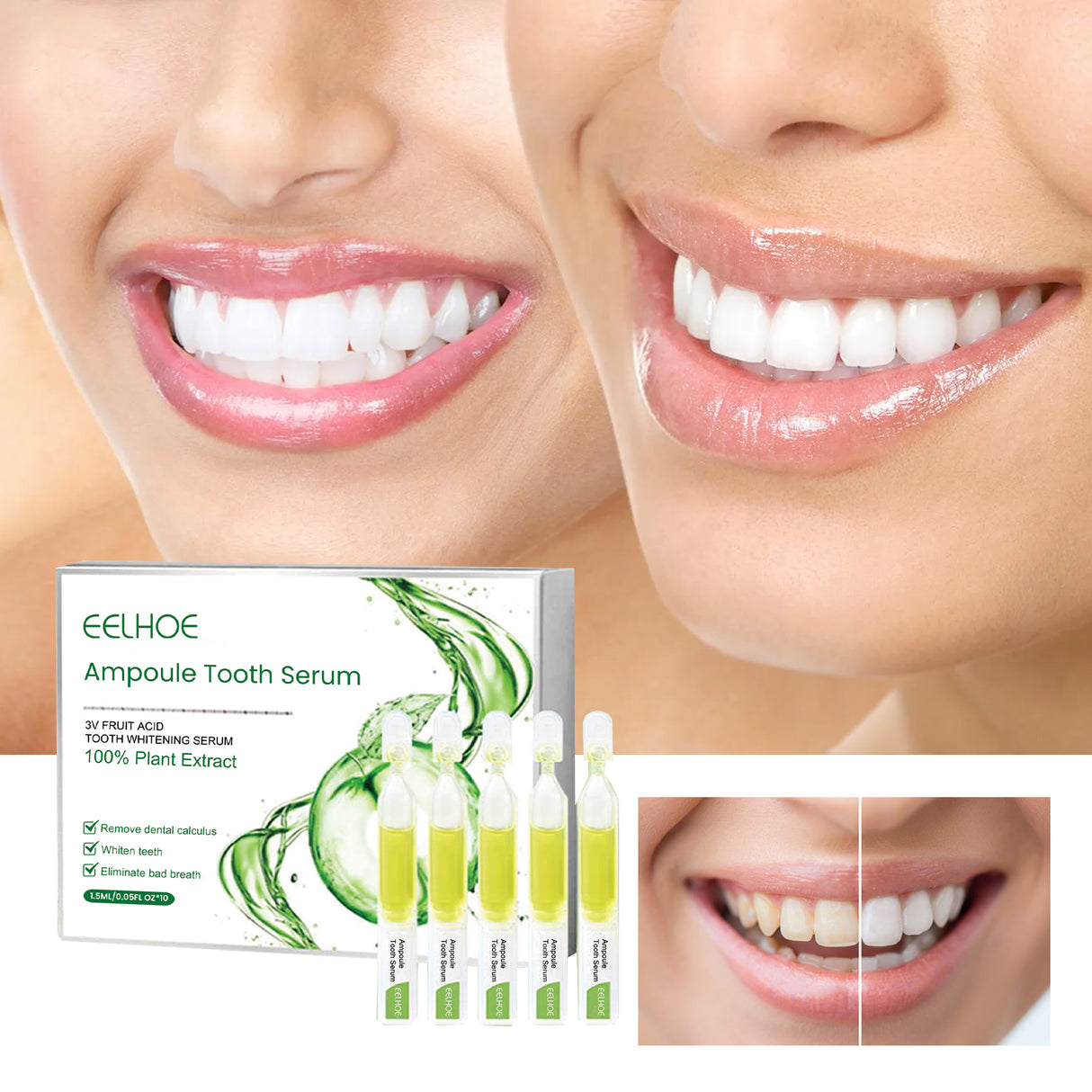 Teeth Whitening Serum To Remove Stains, Bad Breath, Whitening Teeth And Whitening Teeth - V.I.P Digital Presence