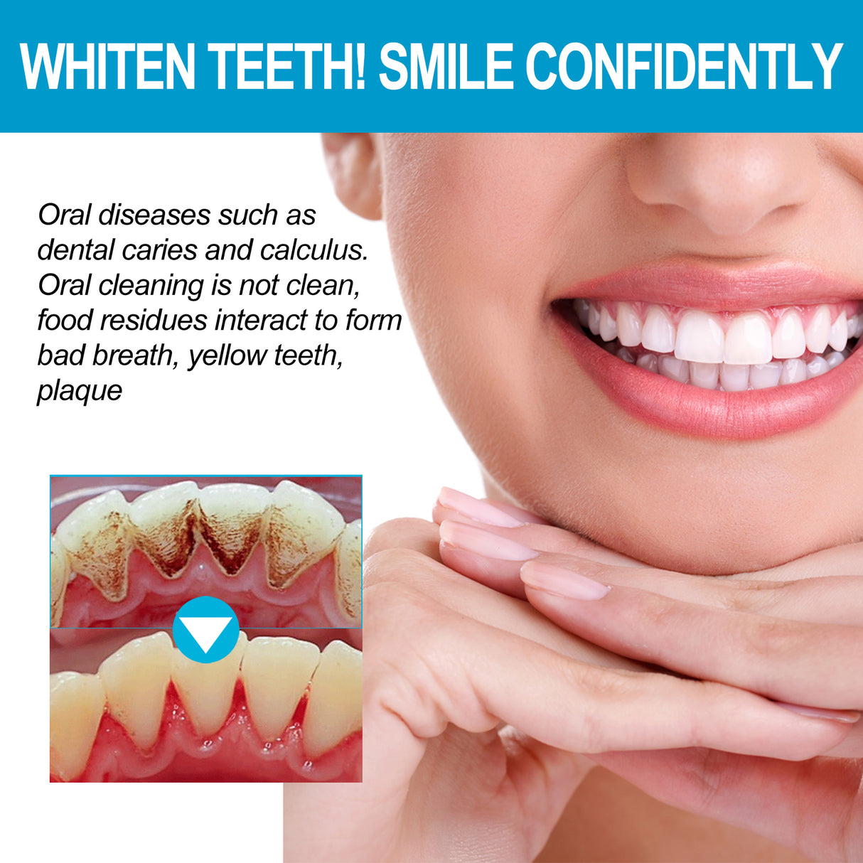 Jelly Cup Mouthwash Cleans Bad Breath, Teeth Stains, Smoke Stains, Brightening Teeth And Refreshing Breath - V.I.P Digital Presence