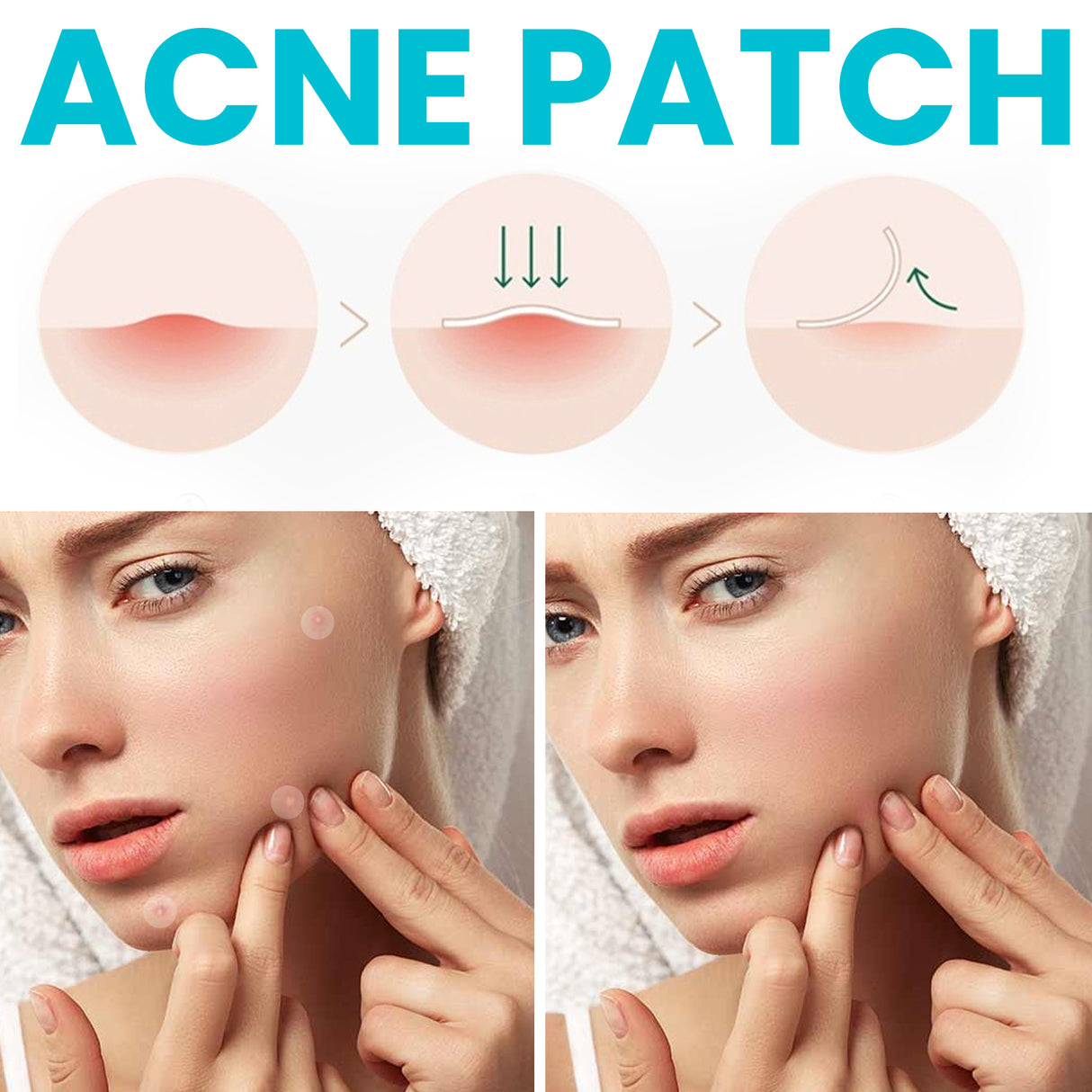 Acne Patch, Repair Facial Acne Invisible Concealer Hydrocolloid Patch - V.I.P Digital Presence