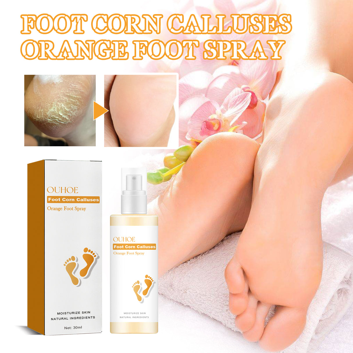 Foot Calluses Moisturizing Spray, Repair Heel Calluses, Remove Dead Skin, Moisturize And Moisturize Foot Care - V.I.P Digital Presence