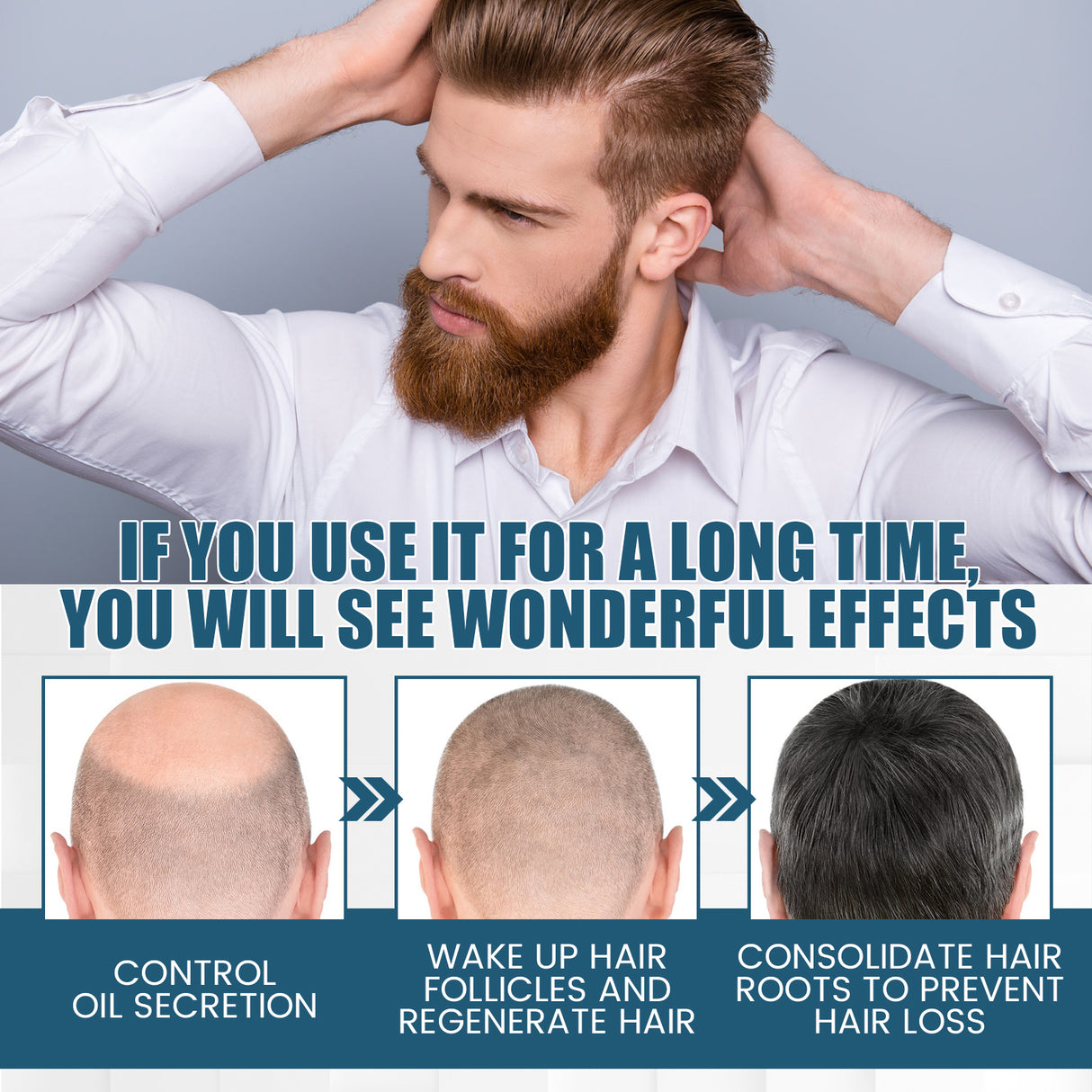 Hair Essence Spray, Prevent Hair Loss Repair Hair Dry And Frizzy Moisture And Dense Hair Essence - V.I.P Digital Presence