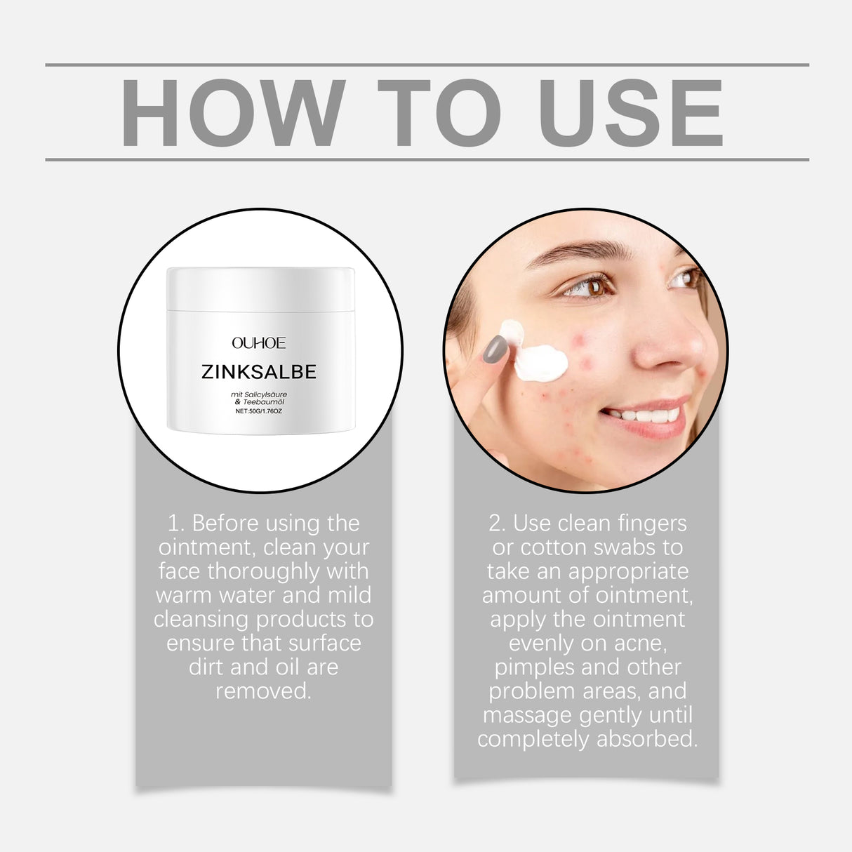 Facial Acne Cream, Gentle Nourishing And Repairing Facial Acne Daily Cream