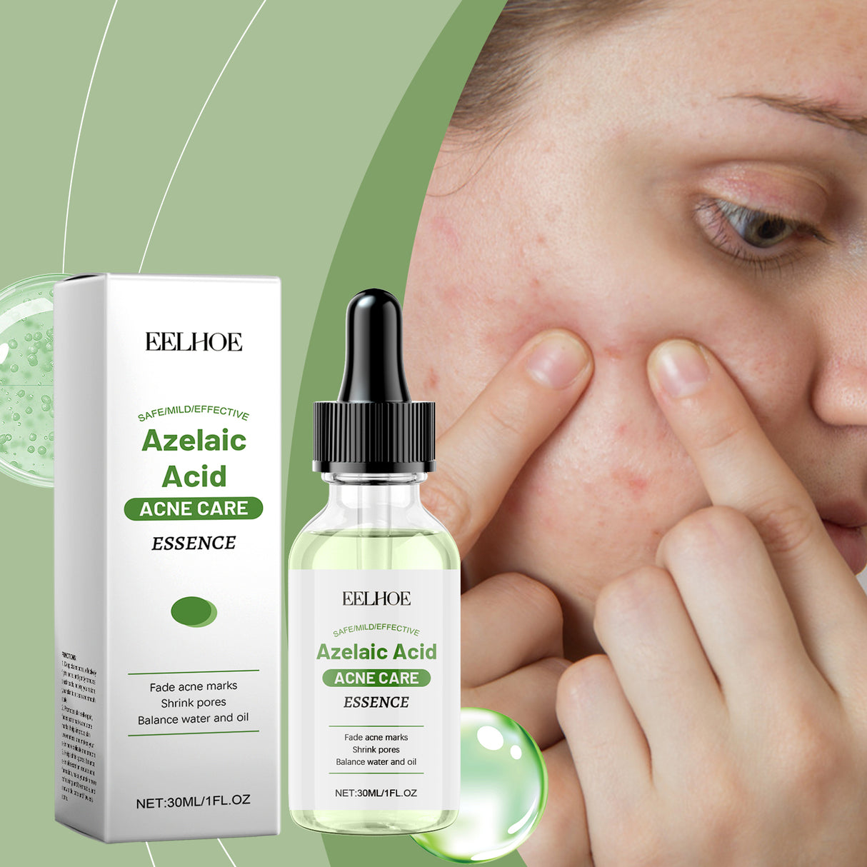 Azelaic Acid Facial Essence Moisturizes And Improves The Skin For Blackheads And Acne