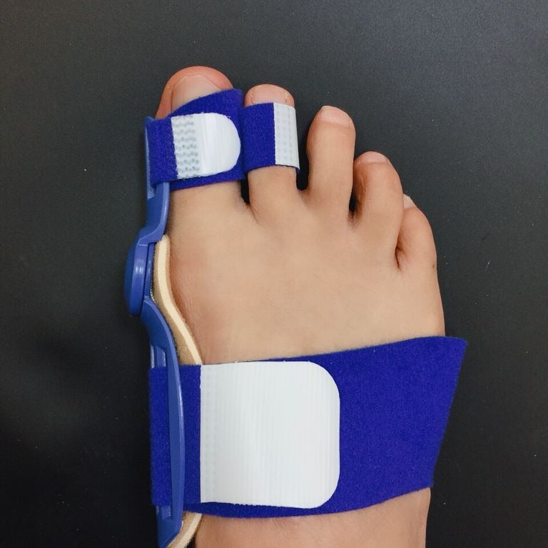 Day And Night Use Of Hallux Valgus Orthosis Thumb Valgus Orthosis Toe Orthosis - V.I.P Digital Presence