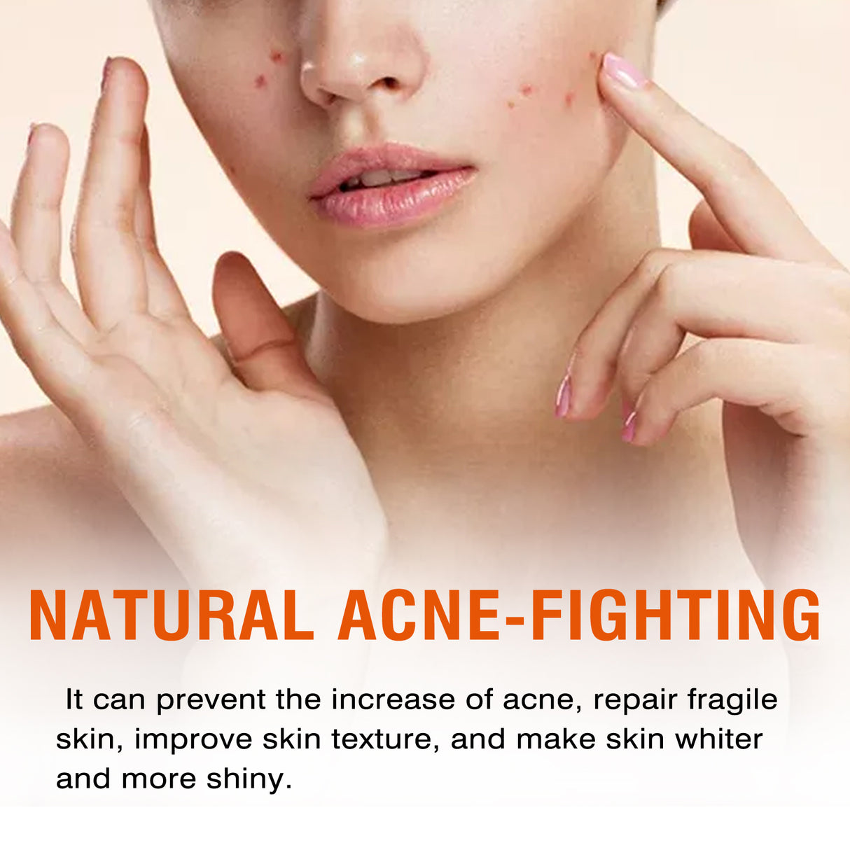 Salicylic Acid Facial Mask Gentle Cleansing Mask To Lighten Acne, Seal And Tighten Pores - V.I.P Digital Presence