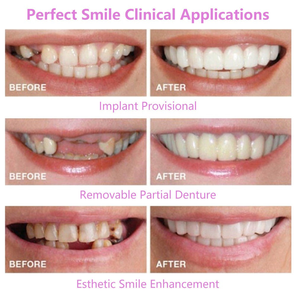 Simulation braces smile whitening sixth generation non-porous teeth set dentures - V.I.P Digital Presence