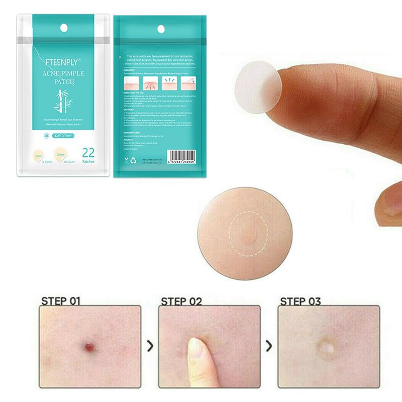 22Pcs/Sheet Acne Pimple Patch Invisible Acne Stickers Blemish Treatment Acne Master Pimple Remover Tool Skin Care - V.I.P Digital Presence