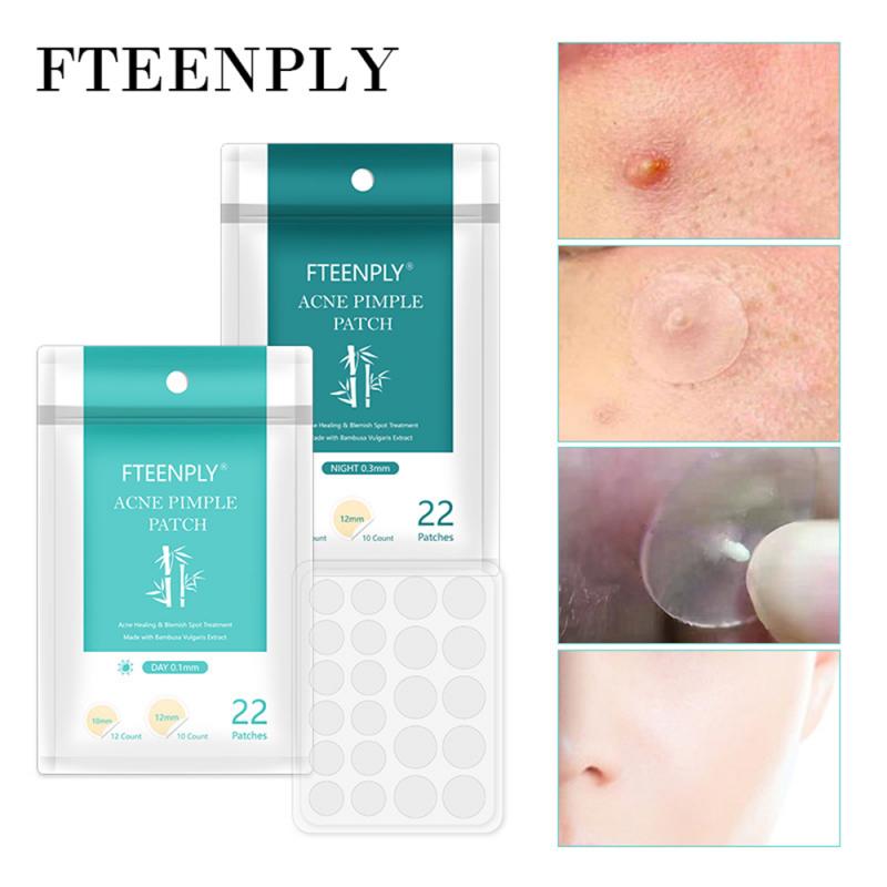 22Pcs/Sheet Acne Pimple Patch Invisible Acne Stickers Blemish Treatment Acne Master Pimple Remover Tool Skin Care - V.I.P Digital Presence
